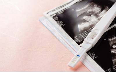An image of a baby scan and an pregnancy test showing positive